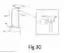 Fig. 07 - Variable depth surgical fixation