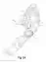 Fig. 19 - Variable depth surgical fixation