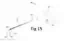 Fig. 20 - Variable depth surgical fixation