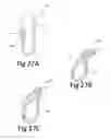 Fig. 30 - Variable depth surgical fixation