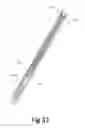 Fig. 35 - Variable depth surgical fixation