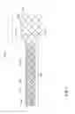 Fig. 06 - Stent including anti-migration capabilities