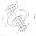 Fig. 02 - Stent including displacement capabilities