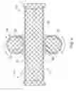 Fig. 05 - Stent including displacement capabilities