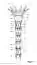 Fig. 08 - Temporary diameter reduction constraint arrangement for a stent graft in combination with a stent graft