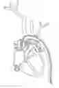 Fig. 01 - Vessel access catheter