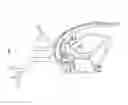 Fig. 08 - Vessel access catheter