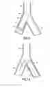 Fig. 07 - STENT/GRAFT ASSEMBLY