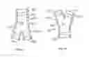 Fig. 32 - STENT/GRAFT ASSEMBLY