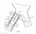Fig. 35 - STENT/GRAFT ASSEMBLY