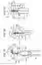 Fig. 04 - Flexible implant with adjustable coils