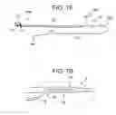 Fig. 07 - Flexible implant with adjustable coils