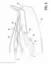 Fig. 04 - Accommodating intraocular lenses and methods of use
