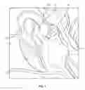 Fig. 02 - Systems and methods for performing ossicular chain reconstructions