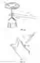 Fig. 15 - Systems and methods for performing ossicular chain reconstructions