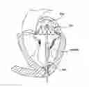 Fig. 01 - Valve delivery system having an integral displacement component for managing chordae tendineae in situ and methods of use thereof