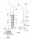 Fig. 06 - Valve delivery system having an integral displacement component for managing chordae tendineae in situ and methods of use thereof