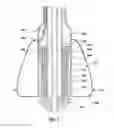 Fig. 08 - Valve delivery system having an integral displacement component for managing chordae tendineae in situ and methods of use thereof