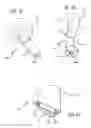 Fig. 08 - Mitral value prosthesis with atrial anchoring