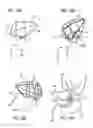 Fig. 15 - Mitral value prosthesis with atrial anchoring