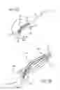 Fig. 18 - Mitral value prosthesis with atrial anchoring