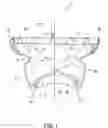 Fig. 02 - Transcatheter valve prosthesis
