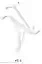 Fig. 09 - Transcatheter valve prosthesis
