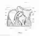 Fig. 03 - Medical device, kit and method for constricting tissue or a bodily orifice, for example, a mitral valve