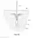 Fig. 07 - Medical device, kit and method for constricting tissue or a bodily orifice, for example, a mitral valve