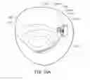 Fig. 35 - Medical device, kit and method for constricting tissue or a bodily orifice, for example, a mitral valve
