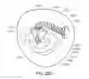 Fig. 41 - Medical device, kit and method for constricting tissue or a bodily orifice, for example, a mitral valve