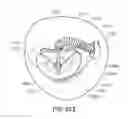 Fig. 43 - Medical device, kit and method for constricting tissue or a bodily orifice, for example, a mitral valve