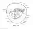 Fig. 44 - Medical device, kit and method for constricting tissue or a bodily orifice, for example, a mitral valve