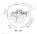 Fig. 49 - Medical device, kit and method for constricting tissue or a bodily orifice, for example, a mitral valve
