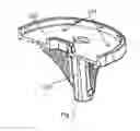 Fig. 02 - TIBIAL SUPPORT OF ARTIFICIAL KNEE JOINT