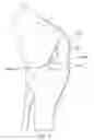 Fig. 02 - Partial unicompartmental system for partial knee replacement