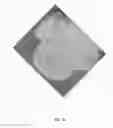 Fig. 09 - Degradable Cage For Bone Fusion