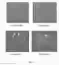 Fig. 16 - Degradable Cage For Bone Fusion