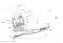 Fig. 01 - Foot prosthesis