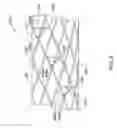 Fig. 09 - Stent anchoring system