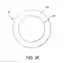 Fig. 09 - Stent having adjacent elements connected by narrow flexible webs