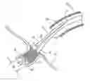 Fig. 01 - STENT POSITIONING SYSTEM AND METHOD