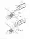 Fig. 04 - STENT POSITIONING SYSTEM AND METHOD