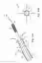 Fig. 06 - STENT POSITIONING SYSTEM AND METHOD