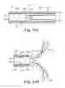 Fig. 08 - STENT POSITIONING SYSTEM AND METHOD