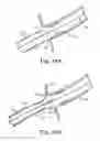 Fig. 09 - STENT POSITIONING SYSTEM AND METHOD