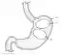 Fig. 01 - Pressure control system for intragastric device