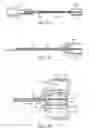 Fig. 09 - Pressure control system for intragastric device