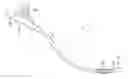 Fig. 01 - Valve Assembly for Modifying Flow in a Catheter System