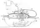 Fig. 01 - Reduced-pressure systems, devices, and methods for treating a tissue site that includes a fistula